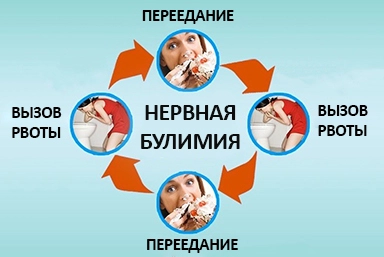 Лечение булимии в Углеуральском